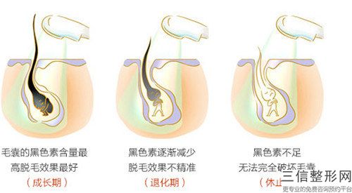 做手臂激光脱毛哪里比较安全,做手臂激光脱毛术安全不安全