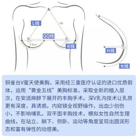 成都铜雀台隆胸专家雷刚科普隆胸整形