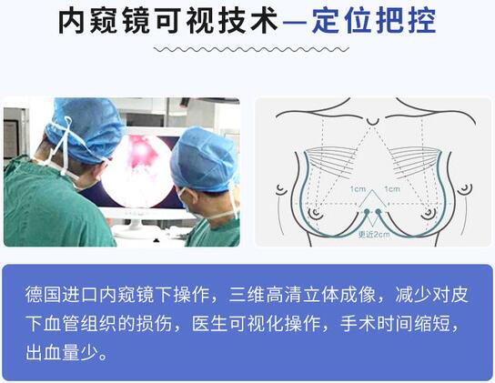 成都铜雀台隆胸专家雷刚科普隆胸整形