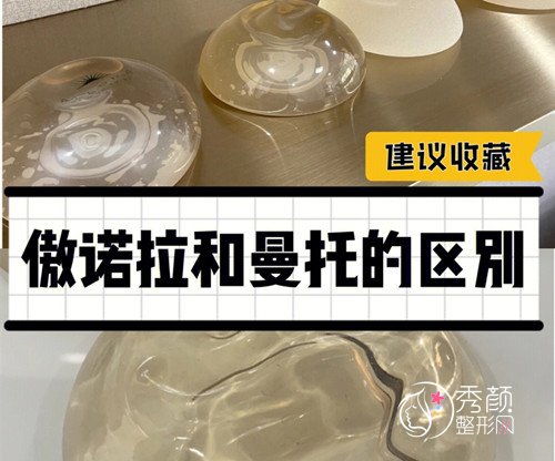 隆胸假体：傲诺拉假体和曼托假体怎么选？哪个更自然？