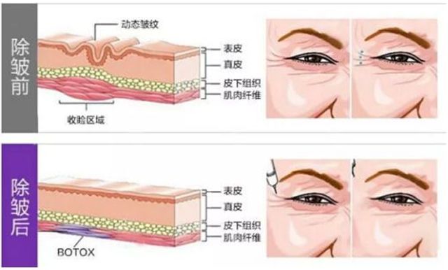 抗衰老是女人要经营一辈子的事业