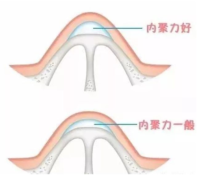 【专家解答】鼻子经常打玻尿酸会变宽吗？