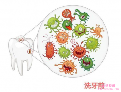 该不该洗牙？超声波洗牙解疑