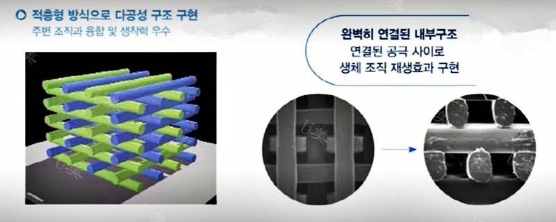 韩国mesh材料为何优于膨体？